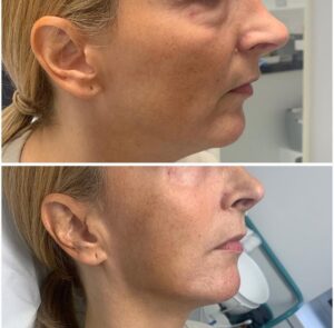 WhatsApp-Image-2021-12-27-at-22.51.23-300x295